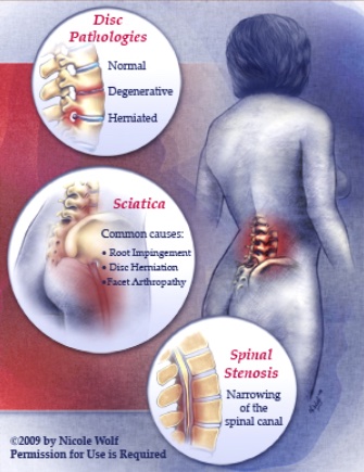 Back Pain diagnosis & treatment options NJ