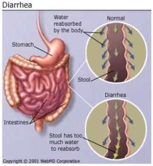 Digestive health and diarrhea