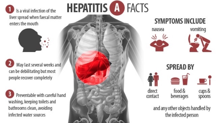 Hepatitis