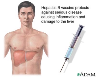 hepatitis