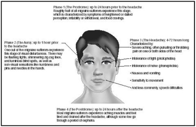 severe migraine headaches