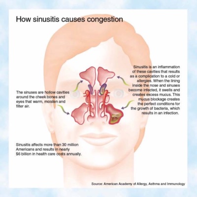 Ears clogged deals sinus infection