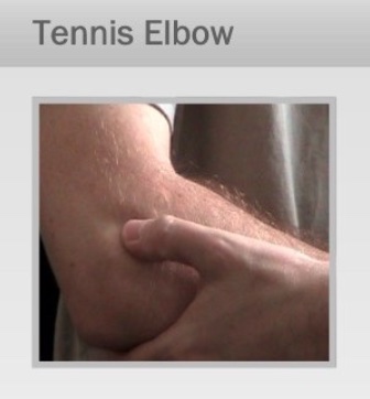 Tennis Elbow