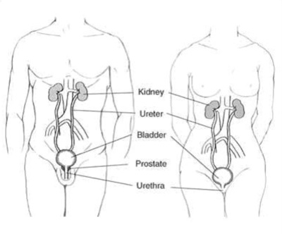 Urinary Tract Infection